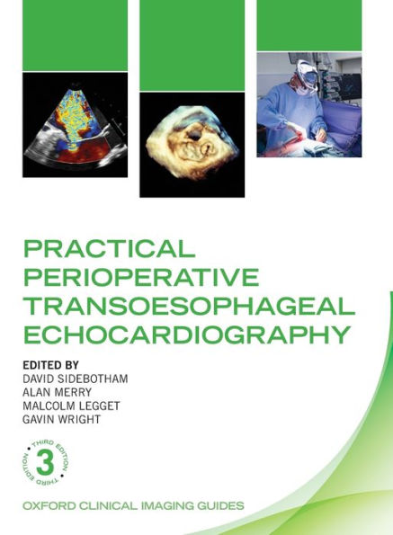 Practical Perioperative Transoesophageal Echocardiography / Edition 3